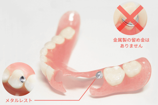 ノン・クラスプ・デンチャーイメージ